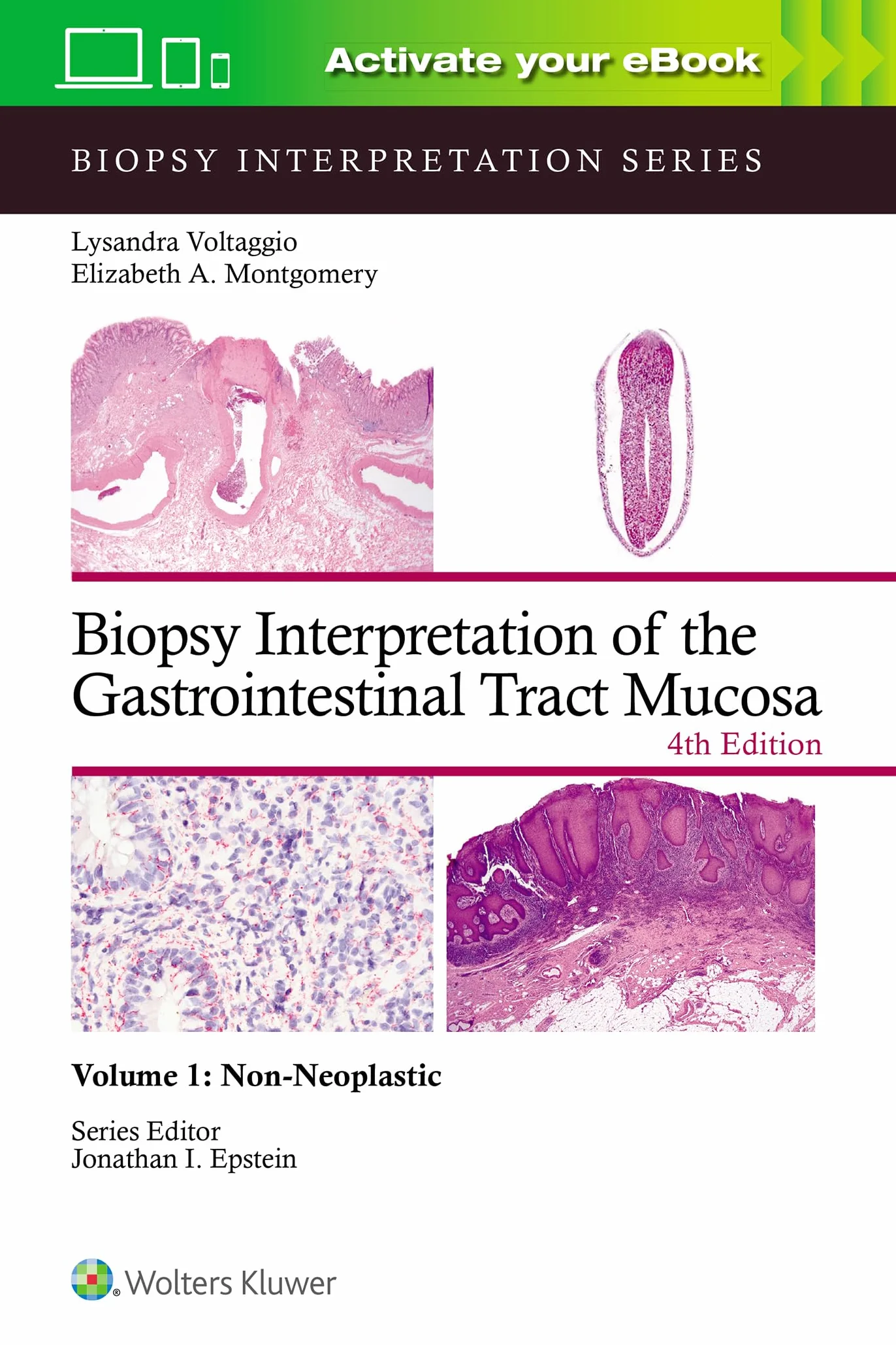 Biopsy Interpretation of the Gastrointestinal Tract Mucosa Volume 1: Non-Neoplastic: Print + eBook with Multimedia (Volume 1) (Biopsy Interpretation Series)