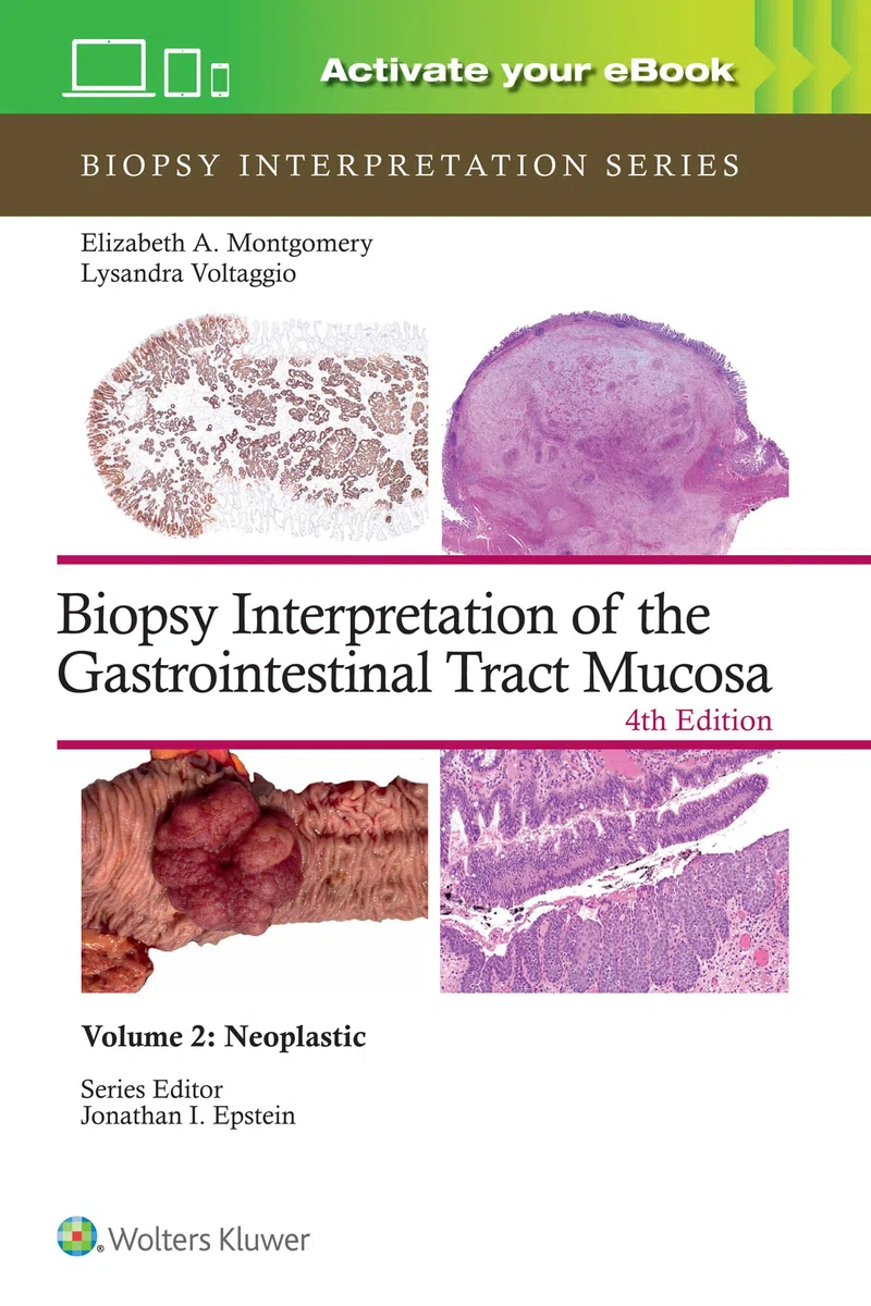 Biopsy Interpretation of the Gastrointestinal Tract Mucosa Volume 2: Neoplastic: Print + eBook with Multimedia (Volume 2) (Biopsy Interpretation Series)