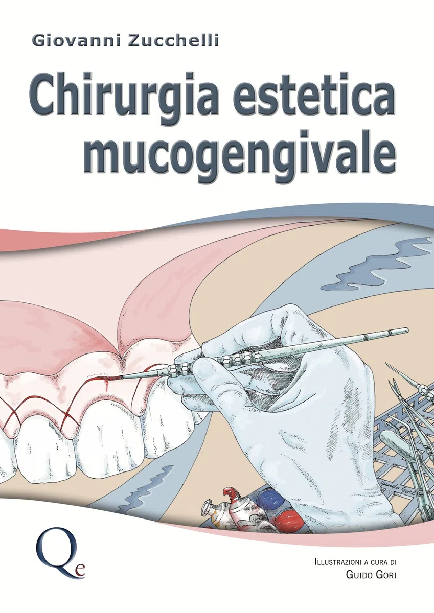 Chirurgia estetica mucogengivale